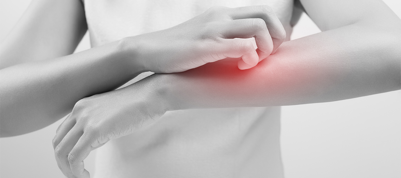 Dr. Ahmet Acar Egzama Nedir? Egzamaların Çeşitleri, Sebepleri ve Belirtileri Nelerdir?