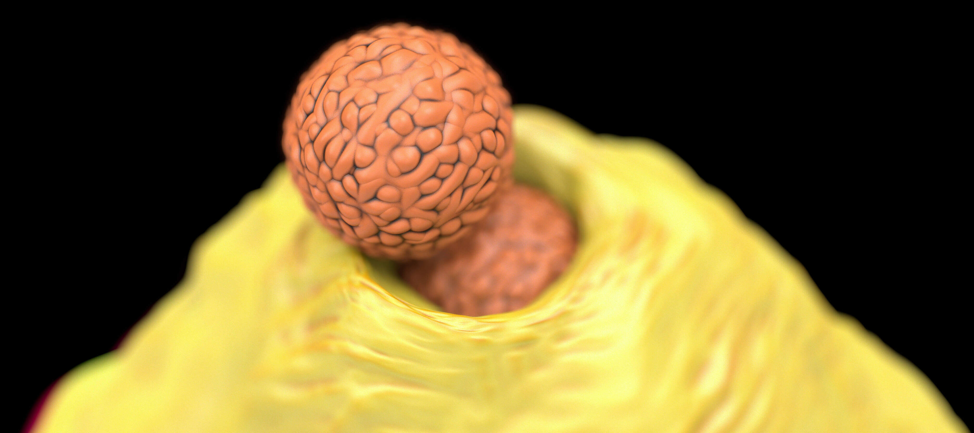 Çıban Nedir? Çıban Neden Çıkar? Belirtileri ve Tedavisi Dr. Ahmet Acar