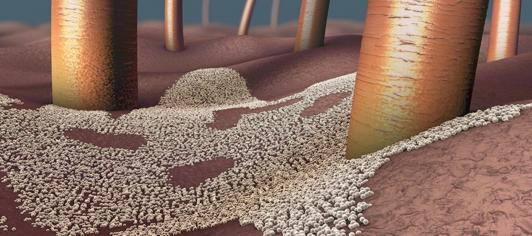 Cilt Mantarı Nedir? Nasıl Bulaşır, Çeşitleri, Belirtileri ve Tedavisi