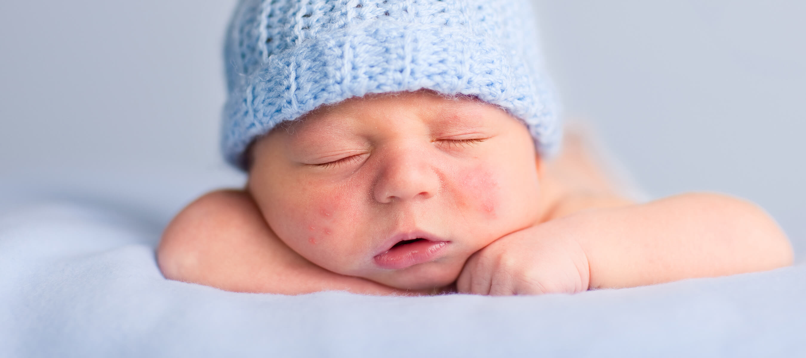 İsilik Nedir? İsilik Neden Olur ve Nasıl Geçer? Dr. Ahmet Acar