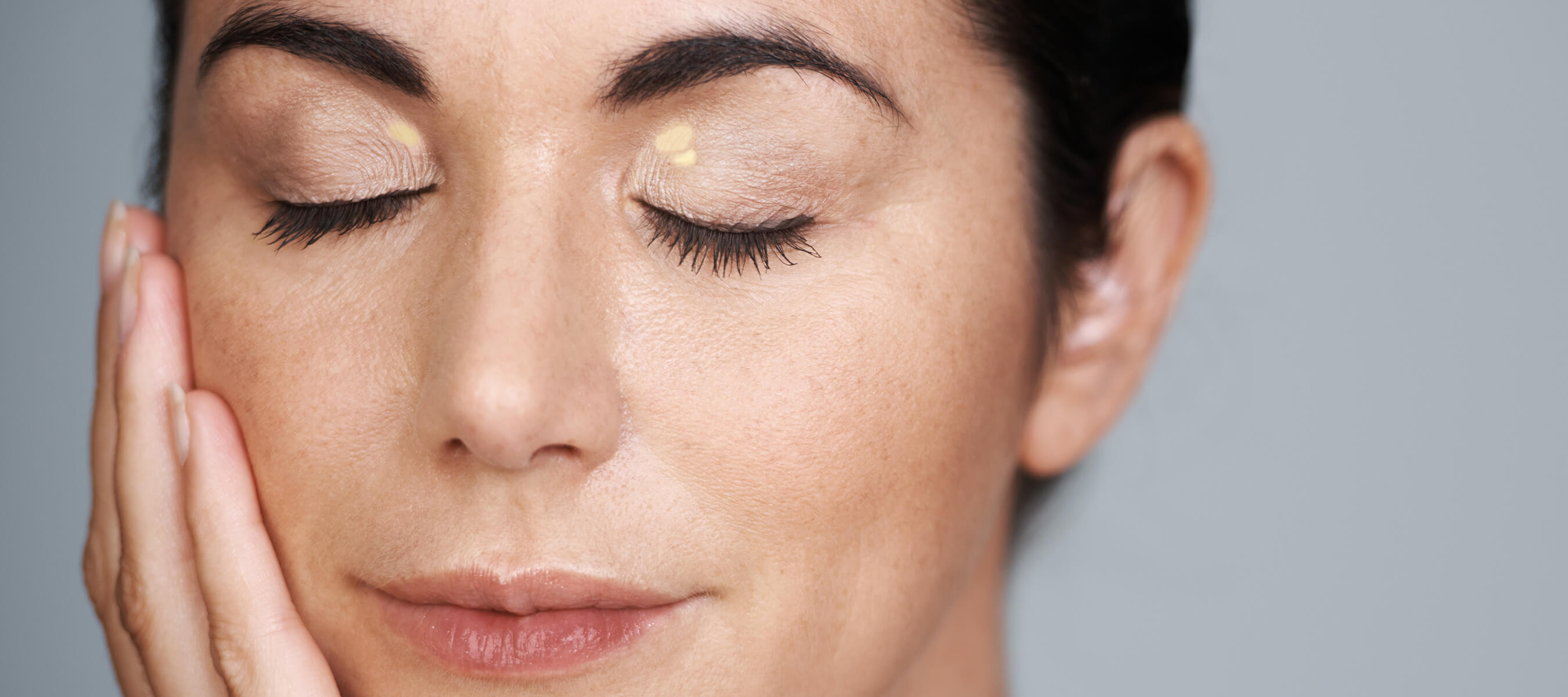 Ksantelazma Nedir? Göz Kapağında Sarı Lekeler ve Tedavisi Dr. Ahmet Acar