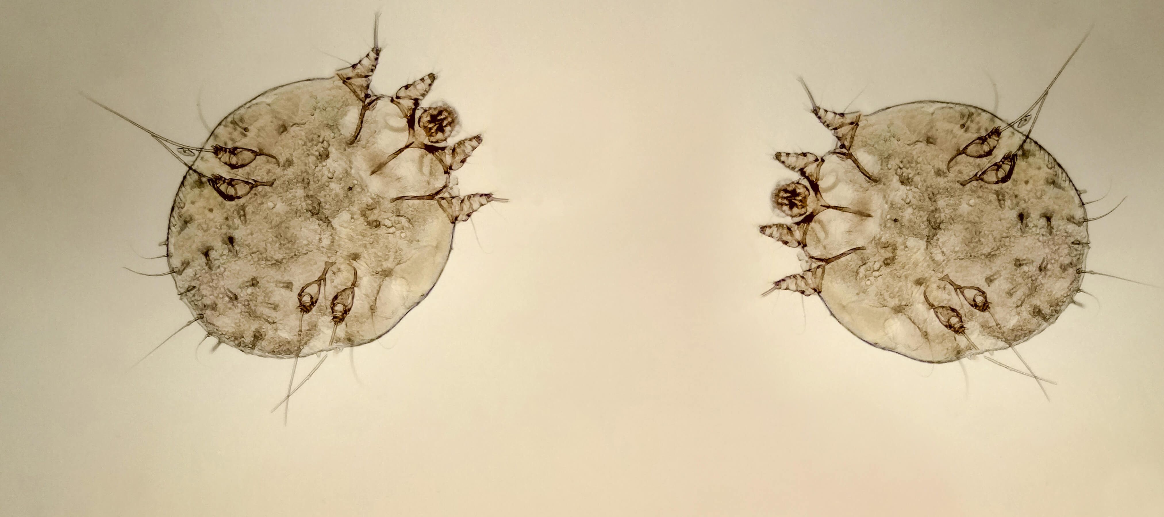 Uyuz Hastalığı Nedir? Uyuz Nasıl Bulaşır? Belirtileri ve Tedavisi Dr. Ahmet Acar