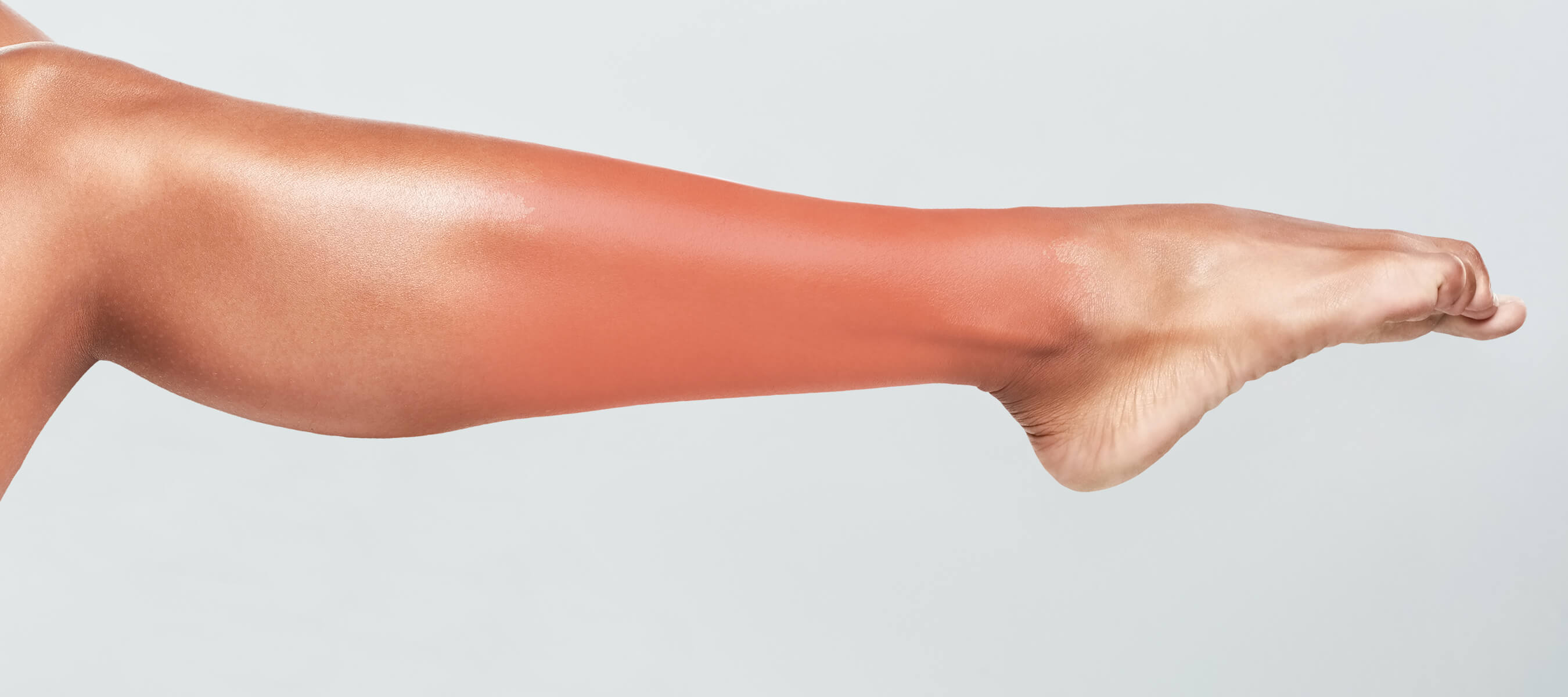 Yılancık Hastalığı Nedir? Nasıl Tedavi Edilir? Dr. Ahmet Acar